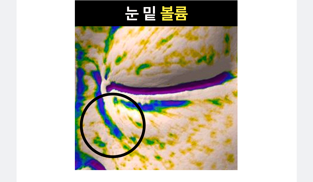 레티놀 비타 아이패치 30